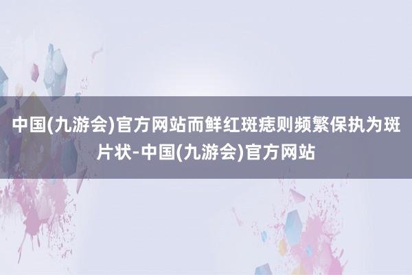 中国(九游会)官方网站而鲜红斑痣则频繁保执为斑片状-中国(九游会)官方网站